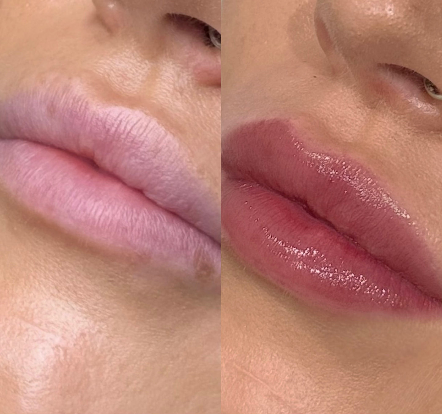 Semi-Permanent Lip Blush