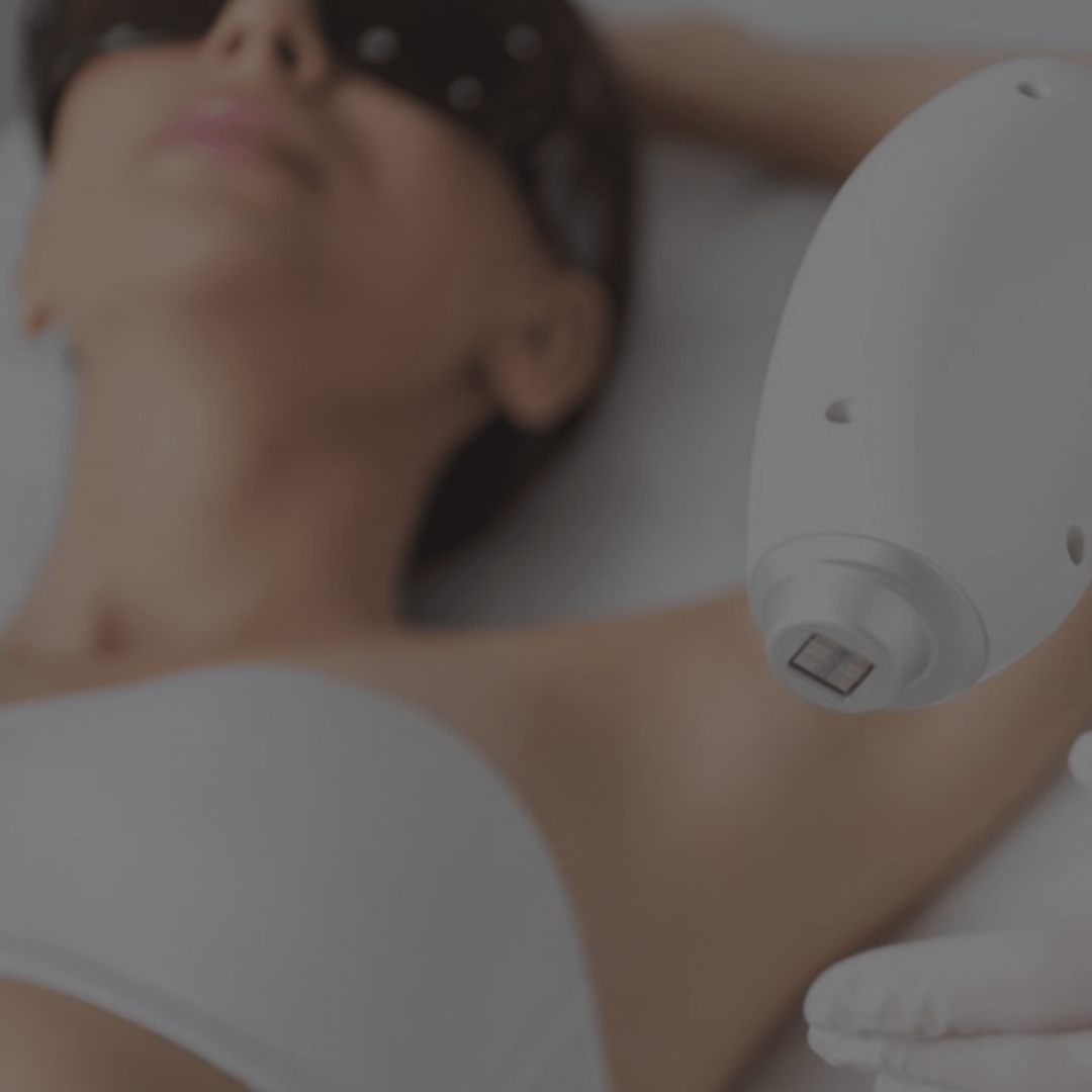 Any Bikini & Underarms - course of 6 Cork - Laser Hair Removal & Beauty | skybeautyandlaser.ie